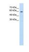 Solute Carrier Family 11 Member 1 antibody, NBP1-59785, Novus Biologicals, Western Blot image 