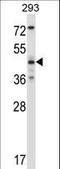 Mitogen-Activated Protein Kinase 9 antibody, LS-C164474, Lifespan Biosciences, Western Blot image 