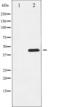 Tyrosine Hydroxylase antibody, TA325935, Origene, Western Blot image 