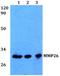 Matrix Metallopeptidase 26 antibody, A08079, Boster Biological Technology, Western Blot image 
