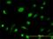 Adenylate Kinase 1 antibody, H00000203-M06, Novus Biologicals, Immunofluorescence image 