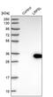 LDL Receptor Related Protein 5 Like antibody, PA5-55961, Invitrogen Antibodies, Western Blot image 