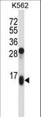 Guanylate Cyclase Activator 2A antibody, LS-C166741, Lifespan Biosciences, Western Blot image 