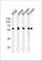 Ubiquitin Specific Peptidase 14 antibody, MA5-24727, Invitrogen Antibodies, Western Blot image 