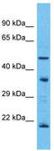 Olfactory Receptor Family 5 Subfamily T Member 3 antibody, TA332312, Origene, Western Blot image 