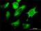 FAS antibody, H00002194-M01, Novus Biologicals, Immunocytochemistry image 