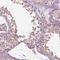 Rho Family GTPase 2 antibody, HPA077757, Atlas Antibodies, Immunohistochemistry frozen image 