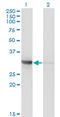 Cyclin Dependent Kinase 2 antibody, LS-C196879, Lifespan Biosciences, Western Blot image 