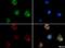 S100 Calcium Binding Protein A9 antibody, NB110-89726, Novus Biologicals, Immunocytochemistry image 