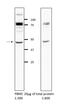 Glycine Receptor Alpha 2 antibody, 13831-1-AP, Proteintech Group, Western Blot image 