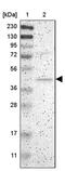 ArfGAP With Dual PH Domains 1 antibody, PA5-52378, Invitrogen Antibodies, Western Blot image 