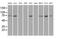 Fermitin Family Member 2 antibody, MA5-24938, Invitrogen Antibodies, Western Blot image 