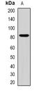 Zinc Finger And BTB Domain Containing 20 antibody, orb341407, Biorbyt, Western Blot image 
