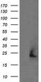 Amyloid P Component, Serum antibody, M00162, Boster Biological Technology, Western Blot image 