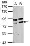 Poly(A)-Specific Ribonuclease antibody, NBP2-19696, Novus Biologicals, Western Blot image 