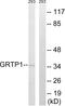 Growth Hormone Regulated TBC Protein 1 antibody, GTX87173, GeneTex, Western Blot image 