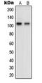 OCRL Inositol Polyphosphate-5-Phosphatase antibody, LS-C352610, Lifespan Biosciences, Western Blot image 