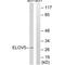 ELOVL Fatty Acid Elongase 5 antibody, A03615, Boster Biological Technology, Western Blot image 