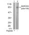 Myristoylated Alanine Rich Protein Kinase C Substrate antibody, GTX50312, GeneTex, Western Blot image 