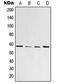 Peroxisome Proliferator Activated Receptor Gamma antibody, MBS820253, MyBioSource, Western Blot image 