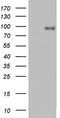 Angiotensin I Converting Enzyme 2 antibody, LS-C338902, Lifespan Biosciences, Western Blot image 