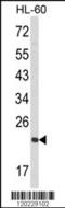 RAN, Member RAS Oncogene Family antibody, MBS9210295, MyBioSource, Western Blot image 