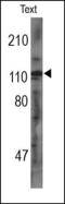 Platelet Derived Growth Factor Receptor Alpha antibody, 200170, Abbiotec, Western Blot image 