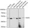 Sorting Nexin 5 antibody, GTX66173, GeneTex, Western Blot image 