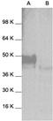 Mitogen-Activated Protein Kinase 8 antibody, GTX27949, GeneTex, Western Blot image 