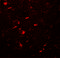 Microtubule Associated Protein 1 Light Chain 3 Beta antibody, 7581, ProSci, Immunofluorescence image 