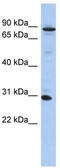 KN Motif And Ankyrin Repeat Domains 3 antibody, TA333373, Origene, Western Blot image 