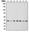 Inhibitor Of Nuclear Factor Kappa B Kinase Regulatory Subunit Gamma antibody, MBS822214, MyBioSource, Western Blot image 
