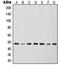 Inhibitor Of Nuclear Factor Kappa B Kinase Regulatory Subunit Gamma antibody, MBS822214, MyBioSource, Western Blot image 