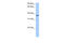 AlkB Homolog 8, TRNA Methyltransferase antibody, 29-494, ProSci, Enzyme Linked Immunosorbent Assay image 