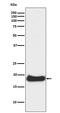 Claudin 1 antibody, M01585, Boster Biological Technology, Western Blot image 