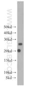 Sodium Voltage-Gated Channel Beta Subunit 2 antibody, 13612-1-AP, Proteintech Group, Western Blot image 