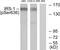 Insulin Receptor Substrate 1 antibody, LS-C117389, Lifespan Biosciences, Western Blot image 