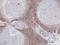 Annexin A7 antibody, LS-C185697, Lifespan Biosciences, Immunohistochemistry paraffin image 