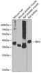 Fructose-Bisphosphatase 2 antibody, GTX66583, GeneTex, Western Blot image 