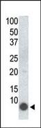 FXYD Domain Containing Ion Transport Regulator 1 antibody, MA5-11124, Invitrogen Antibodies, Western Blot image 