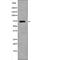 Dual Specificity Phosphatase 16 antibody, abx149933, Abbexa, Western Blot image 