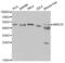 Alpha-Methylacyl-CoA Racemase antibody, abx001044, Abbexa, Western Blot image 