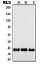 SUMO1 Activating Enzyme Subunit 1 antibody, LS-C353229, Lifespan Biosciences, Western Blot image 