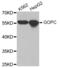 Golgi Associated PDZ And Coiled-Coil Motif Containing antibody, abx003710, Abbexa, Western Blot image 