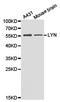 LYN Proto-Oncogene, Src Family Tyrosine Kinase antibody, LS-C192826, Lifespan Biosciences, Western Blot image 