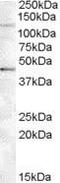 Tankyrase 2 antibody, PA5-18848, Invitrogen Antibodies, Western Blot image 