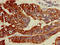 Acyl-CoA Synthetase Long Chain Family Member 5 antibody, LS-C398237, Lifespan Biosciences, Immunohistochemistry paraffin image 