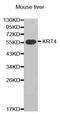 Keratin 4 antibody, MBS126784, MyBioSource, Western Blot image 