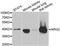 Arginase 2 antibody, LS-C334656, Lifespan Biosciences, Western Blot image 