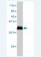 Ring Finger And CHY Zinc Finger Domain Containing 1 antibody, H00025898-M01, Novus Biologicals, Western Blot image 